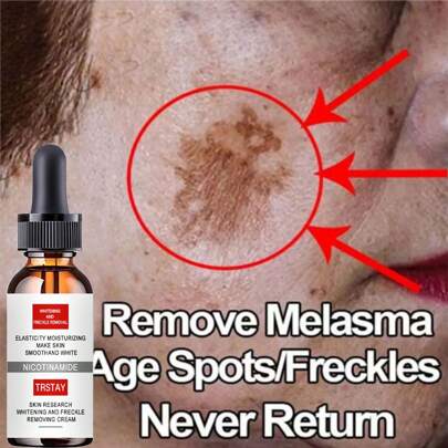 Esencia efectiva contra las pecas que elimina las manchas oscuras, la melasma, ilumina y suaviza el cuidado de la piel