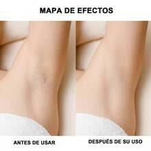 Depilador Multiusos Yes, Kit de depilación profesional para mujer, depiladora táctil recargable, afeitadora de mano para cuerpo, bikini, cara, pierna - Blanco - Ver 6