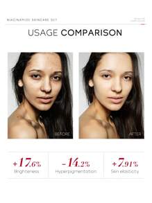 4件套 LAIKOU PRO 烟酰胺护肤套装，包含抗衰老精华液 17ml、亮肤霜 30g、保湿爽肤水 50ml 和控油洁面啫喱 50g，滋养修护护肤礼盒，适合女性、母亲、妻子、姐妹、青少年、女朋友等。 - 白色 - 查看 5