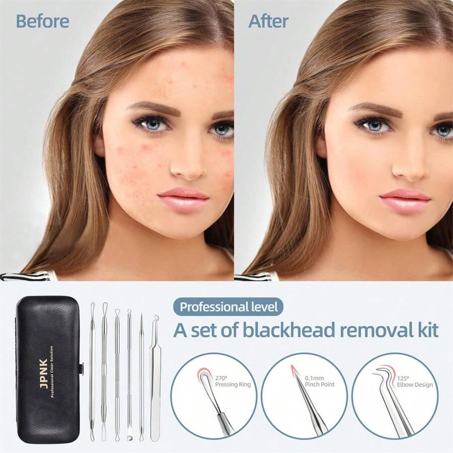 Blackhead Remover Tool Comedones Extractor Acne Removal Kit For Blemish