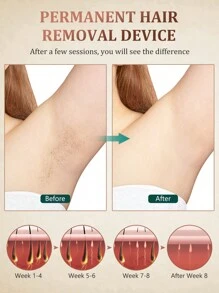 Sejoy IPL Laser Hair Removal Device With Cooling System, Painless Whole-Body Hair Removal Ice Point Hair Removal Device, Green - 美規A型插(110-127V) - 查看 4