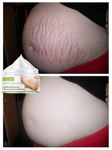 Repair Cream To Repair Skin, Smooth Fine Lines, Moisturize, Smooth, Firm, And Lighten Wrinkles