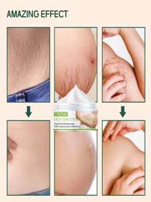Repair Cream To Repair Skin, Smooth Fine Lines, Moisturize, Smooth, Firm, And Lighten Wrinkles
