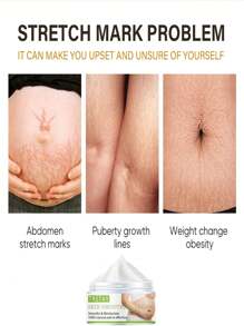 Repair Cream To Repair Skin, Smooth Fine Lines, Moisturize, Smooth, Firm, And Lighten Wrinkles