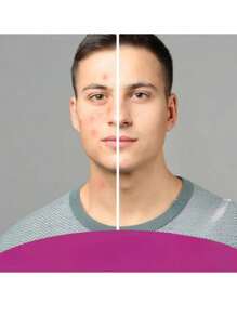 Gel Conductor con Colageno facial Corporal