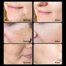 FATAZEN 50ml煙酰胺淡斑修復霜，維他命C面部美白乳液，用於滋養和滋潤肌膚，均勻膚色即時瞬間提亮的面部保濕霜，含透明質酸緩解色素沉澱、減少雀斑、色斑、曬斑和瑕疵 - 黑色 - 查看 11