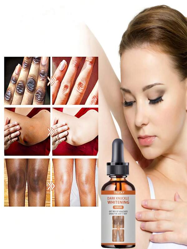 5ML/15ML/30ML/50ML/100ML TRSTAY Skin Brightening Treatment For Dark Spots And Dull Skin - Infused With Vitamin E & Niacinamide
