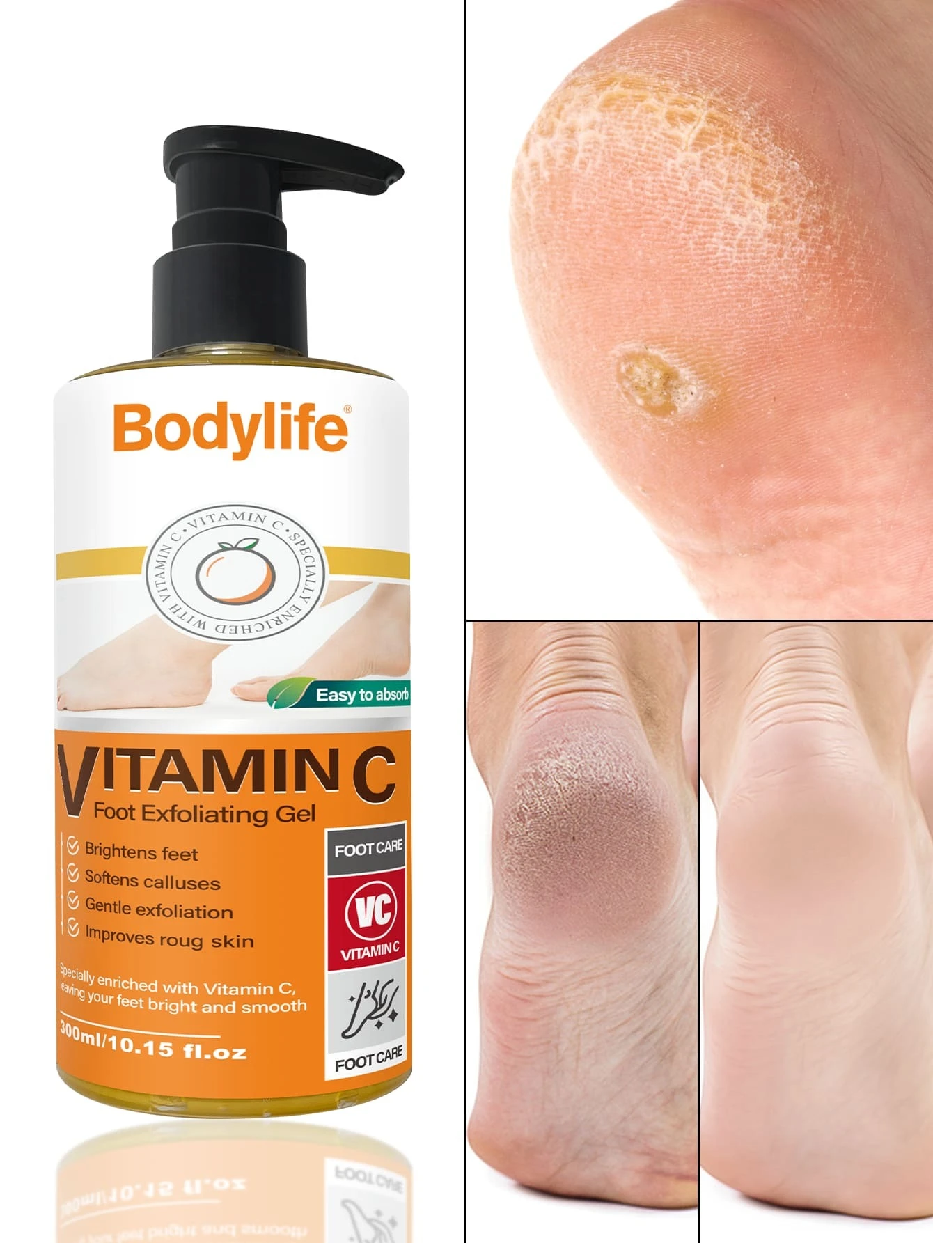 1 Bottle 300ml Vitamin C Foot Exfoliating Gel,For Dry And Cracked Heels & Feet, Prevents