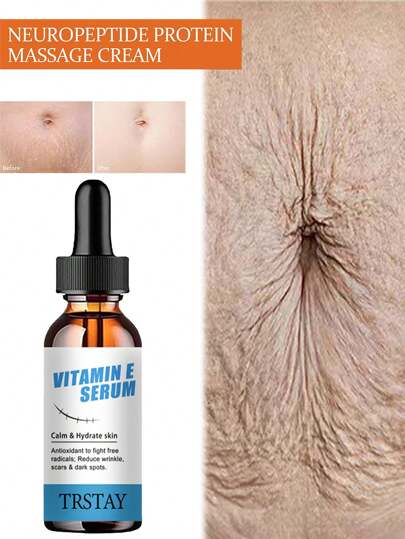 Essence For Removing Stretch Marks, Deep Nourishing Body Essence For Repairing Scars Essence For Removing Stretch Marks
