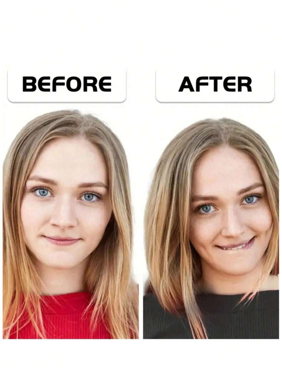 2 Pieces Of Facial Dimple Trainer, Easy To Wear, Helps Form Natural