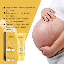 40g Crema de rosa para el cuidado de las estrías del embarazo, crema hidratante y reafirmante posparto para disminuir las estrías - Mostaza Amarilla - Ver 2