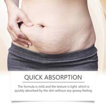 40g Crema de rosa para el cuidado de las estrías del embarazo, crema hidratante y reafirmante posparto para disminuir las estrías - Mostaza Amarilla - Ver 8