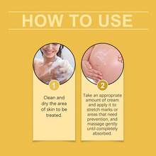 40g Crema de rosa para el cuidado de las estrías del embarazo, crema hidratante y reafirmante posparto para disminuir las estrías - Mostaza Amarilla - Ver 4