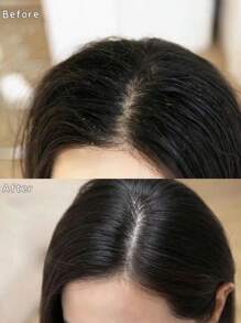 Kérastase KERASTASE[Mini]SYMBIOSE BAIN PURETE ANTI-PELLICULAIRE 洗发水 80ml*3 保湿去屑无硫酸盐洗发水，适用于易生头皮屑的头发和头皮。清洁和滋润头皮和头发 | 适用于易生头皮屑的头皮 | 不含硫酸盐 | 含有吡硫鎓锌 - 80ml*3/240ml - 查看 6