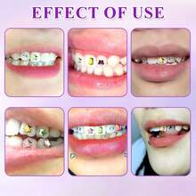 16pcs Rhinestone Dental Kit, Rhinestone Tooth Paw DIY Dental Gem Kit, Professional Rhinestone Dental Kit Tooth Gem Kit Jewellery Dental Kit, Rhinestone Dental Kit And 1 Piece Mouth Opener - Multicolor - View 8