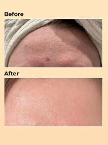 COSRX 蜗牛护肤全套指南 | 旅行套装礼盒，包含洁面啫喱 (0.67 液盎司)、精华液 (1.01 液盎司)、保湿霜 (0.70 液盎司) 和眼霜 (0.16 液盎司)，蕴含蜗牛分泌物，修护、滋养、焕活肌肤，韩国护肤品 - Travel Size - 查看 11