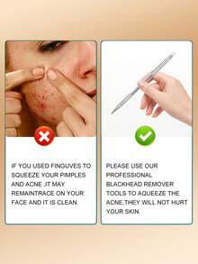 YUANDU Beauty Tool For Removing Blackheads, Acne, And Dead Skin Cells, Pimple Extractor, Comedone Removal Needle And Ring - Silver - View 7
