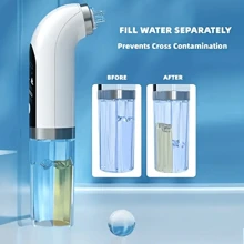 USB 充电黑头提取器 - 持久便携的毛孔吸尘器，打造完美肌肤，轻松清洁面部和去除粉刺，适合作为情侣、男朋友/女朋友的情人节礼物 - 彩色 - 查看 5