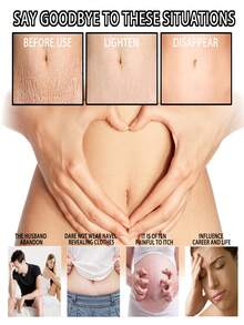 Pregnancy-Specific Formula Stretch Mark Repair Moisturizing Nourishing Cream