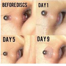 10PCS Piercing Healing Silicone Discs Flexible Anti Hyperplasia Saucer Prevents Irritation Inflammation Drilling Ear Stud Nose Ring Lip Piercing