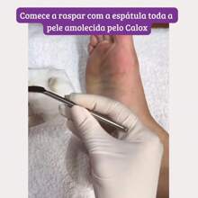 Kit Spa dos Pés Calox Amaciante Calosidades Cora Profissional - Branco - Visão 4