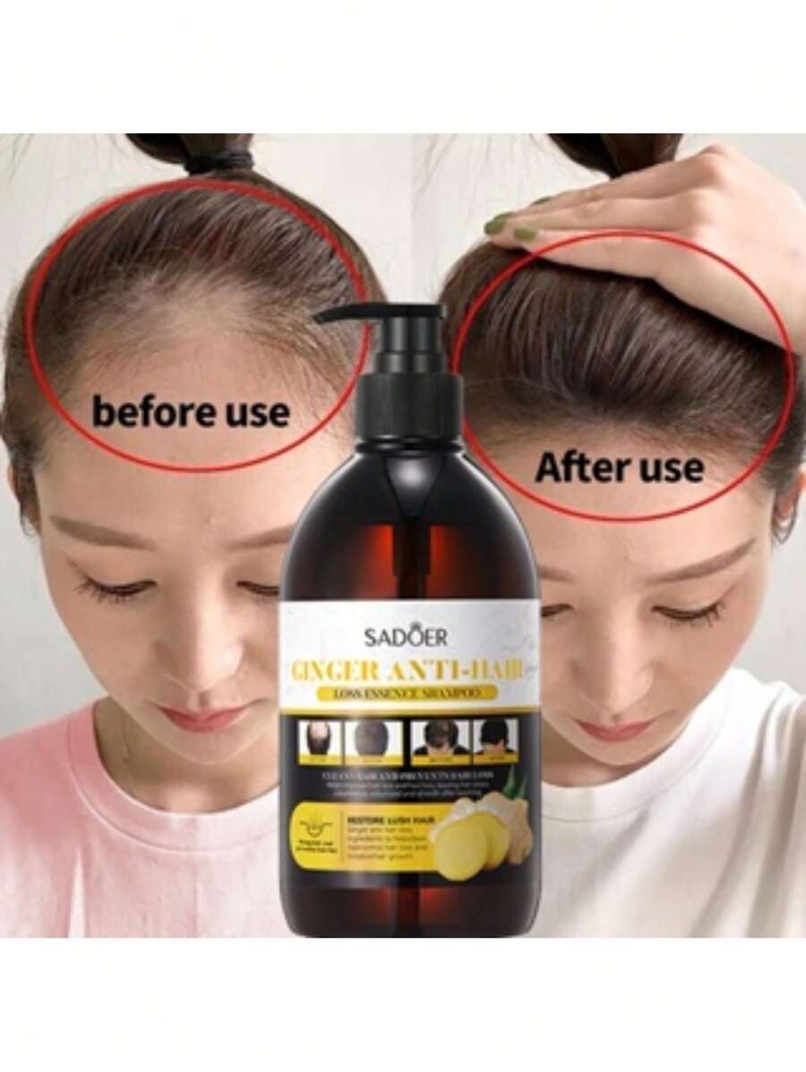 Shampoo De Jengibre y  Argan Sadoer Anti-caída, Crecimiento, Anti-caspa de 400ml, 2 presentaciones  de shampoo con los mismos beneficios(se manda presentacion de shampoo  a disposicion) - Café - Ver 1