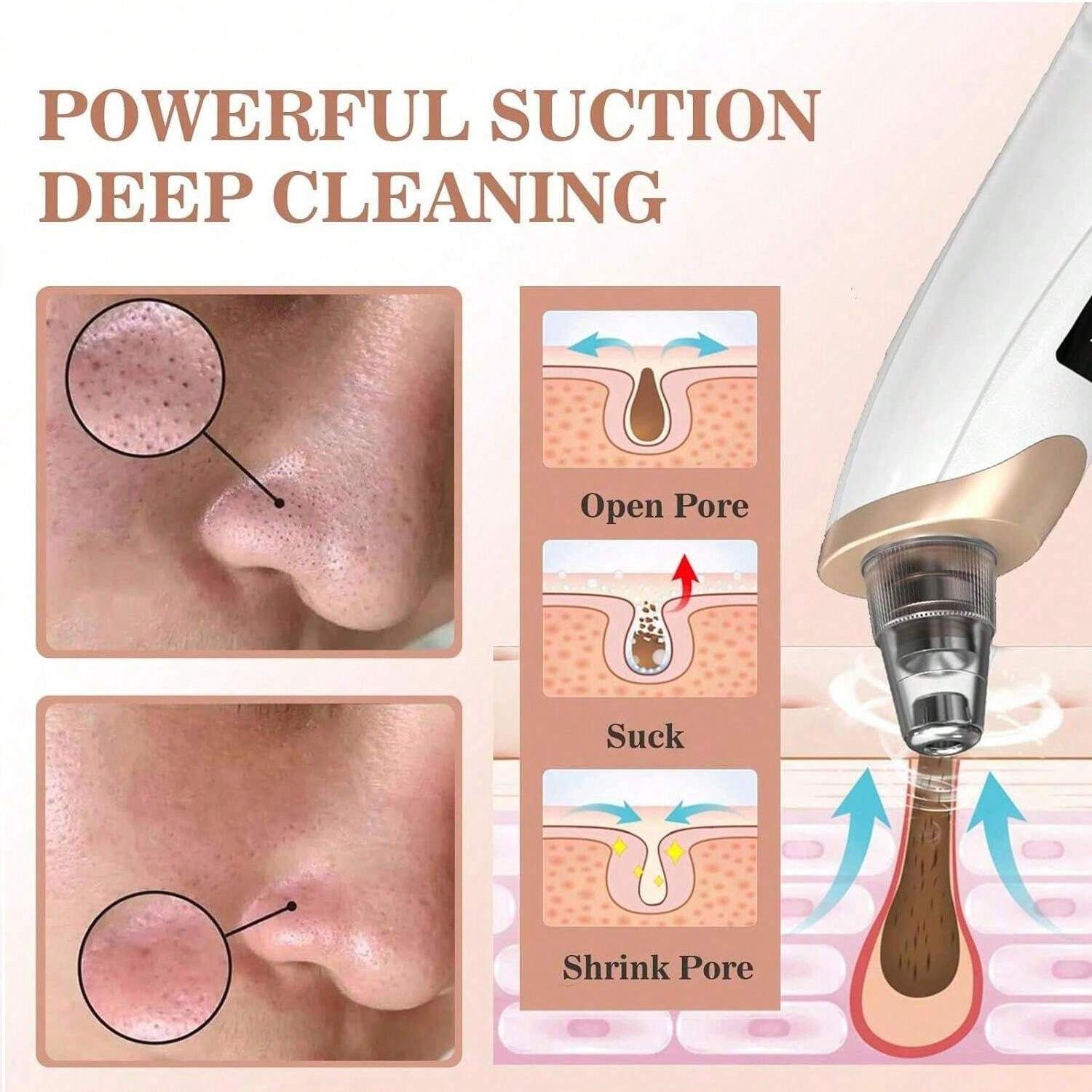 Blackhead Remover Tools Electric Pore Vacuum Extractor For Face Acne ...