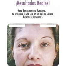 Derma Wand Pro Tonificador Facial Anti Edad Radiofrecuencia - Tipo de Enchufe A USA (110-127V) - Ver 5