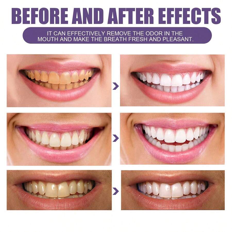 Teeth Whitening Powder Has A Whitening Effect, Which Is Effective For Deep Stains And Can