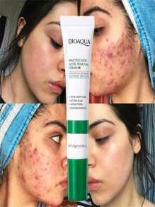 Crema Acné Ácido Salicílico Bioaqua Quita Acné Cicatrices Poros Control de Grasa Puntos Negros - Verde - Ver 4