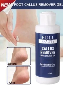 Professioneller Hornhautentferner Extra Stark Spray, Fuß Hornhautentfernung Spray, Peeling Exfoliatoren-Feilen-Gel Fuß Hornhautentferner Sofortiger Fußpeeling-Spray, Abwehr von unnötigen Fuß