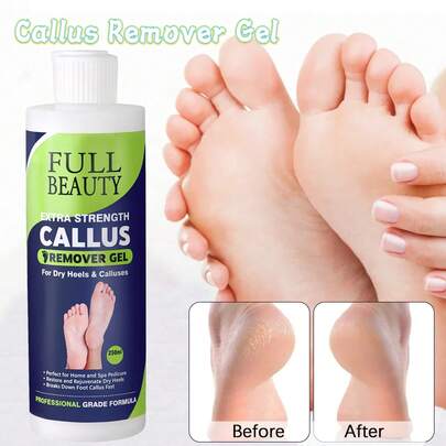 强效去茧凝胶，含泻盐，有效去除老茧、干燥皲裂的脚后跟和异味 - 舒缓疲惫双脚和指甲