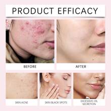 40 片装姜黄提取物清洁垫，温和日常护肤，滋养和提亮肌肤 - 薑黃曲酸清潔墊片 - 查看 9