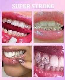 The Original DIY Temporary Tooth Gemz Starter Kit (Crushed Ice)Teeth Gem Kit, DIY Fashionable Crystals Tooth Jewelry Kit, Professional Teeth Gems Kit With Glue.