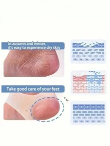 2pcs Silicone Foot Care Moisturizing Gel Socks, Heel Pads - Multicolor - View 5