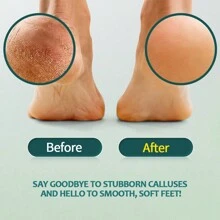 nailpop Nail Cuticle Remover Gel, Callus Remover Gel, Callus Remover For Feet, Foot Callus Remover Gel Set For Dead Skin, Callus Remover For Feet Gel, Quickly And Effortless Remove, Pedicure Tools, Foot Spa, Salon Pedicure Spa Kit