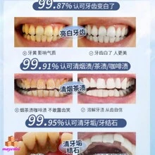 Teeth Whitening - Blue and White - View 6