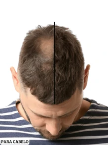 Produto Cresce Cabelo Barba e Sobrancelha Tonico Capilar 30ml