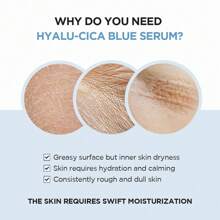 Suero azul Madagascar Centella Hyalu-Cica de 50ml