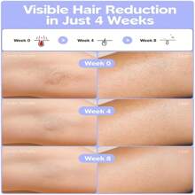 Laser Hair Removal For Women And Men,IPL Hair Removal With Ice-Cooling System For Painless And Permant Result,At Home Hair Removal Device For Armpits Legs Arms Bikini Line - White - View 3