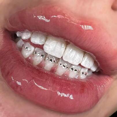 37pcs Luxury Shiny DIY Tooth Jewelry Set, Faux Diamond Tooth Accessories, Minimalist Elegant Style Fashion Tooth Decor For Daily, Party, Gift (Excluding Glue)