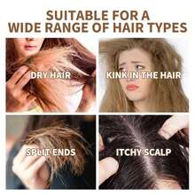 Aceite De Batana Para El Crecimiento Del Cabello Romero Aceite capilar 30ml - Amarillo - Ver 3