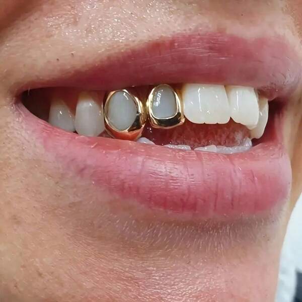 THATBOY 2-In-1 Classic Fashion Top & Bottom Grillz Set, 18K Gold Plated Teeth Grills, Hip Hop Rapper Jewelry Accessory For Men & Women Halloween