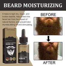 Beard Oil; Men's Beard Oil; 1. Helps Promote Fuller, Healthier Beard Growth. 2. Effectively Removes Excess Keratinization Around The Hair Follicles. Can Deeply Moisturize The Skin And Beard, Preventing Dryness And Coarseness, Making The Beard Softer And More Comfortable.