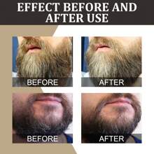 Beard Oil; Men's Beard Oil; 1. Helps Promote Fuller, Healthier Beard Growth. 2. Effectively Removes Excess Keratinization Around The Hair Follicles. Can Deeply Moisturize The Skin And Beard, Preventing Dryness And Coarseness, Making The Beard Softer And More Comfortable.