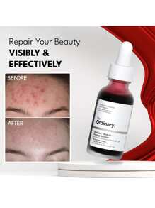 The Ordinary AHA 30% + BHA 2% Peeling Solution - 30ml/1oz - Multicolor - View 2