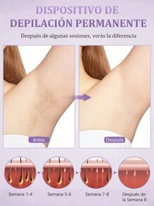 Sejoy Dispositivo electrónico de depilación láser, dispositivo de depilación portátil, dispositivo de depilación con punto de congelación indoloro de alta frecuencia, adecuado para viajes y hogar