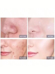 Cerave 水杨酸洁面乳 - 保湿并温和修复屏障