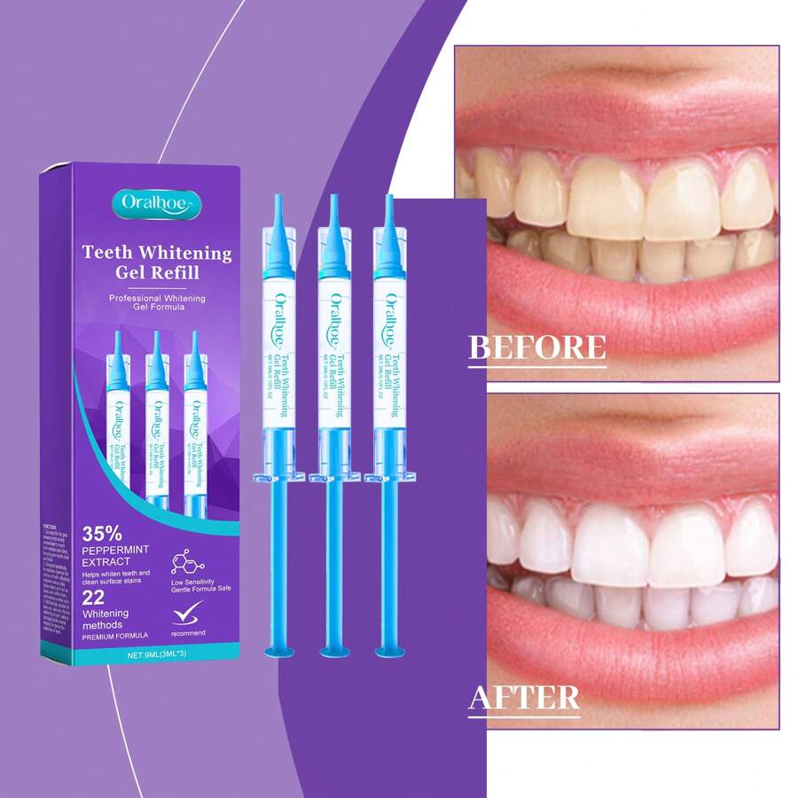 Gel Clareador de Dentes - Clareia os Dentes, Remove Manchas Amareladas ...