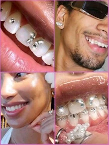 Set de gemas dentales - Kit de pegatinas para dientes de bricolaje autoadhesivas en caja, joyas para dientes de cristal de rinoceronte súper brillantes, calcomanías dentales extraíbles europeas y americanas, cristales decorativos de belleza dental, cristales asimétricos con forma de mariposa de fondo plano, accesorios brillantes y glamorosos de bricolaje para niñas, joyas dentales de cristal súper brillantes, suministros de cuidado oral con estilo personalizado de hip-hop con cristales incrustados, incluye herramientas y pegamento